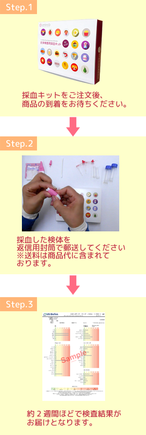 検査
